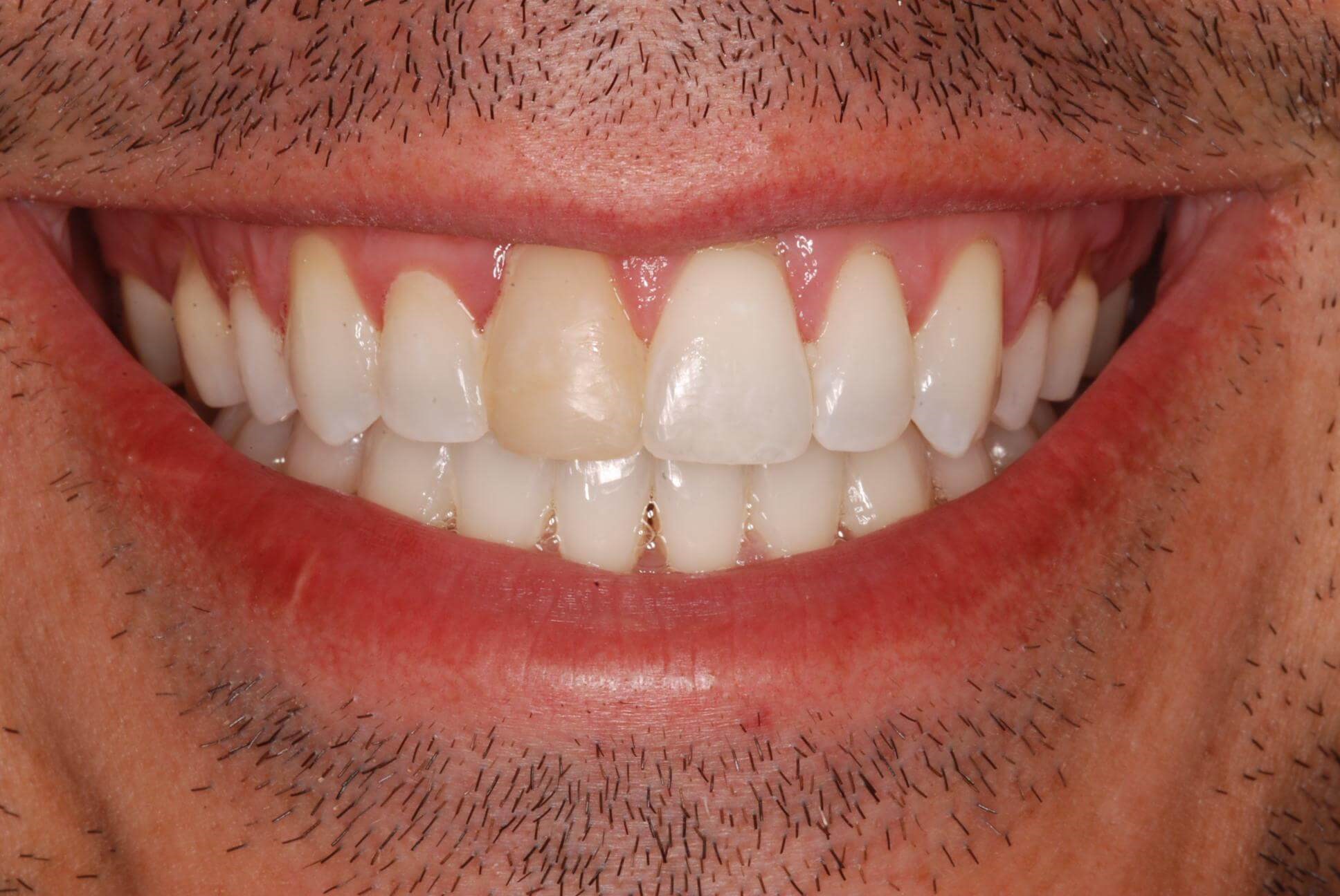 Before Image