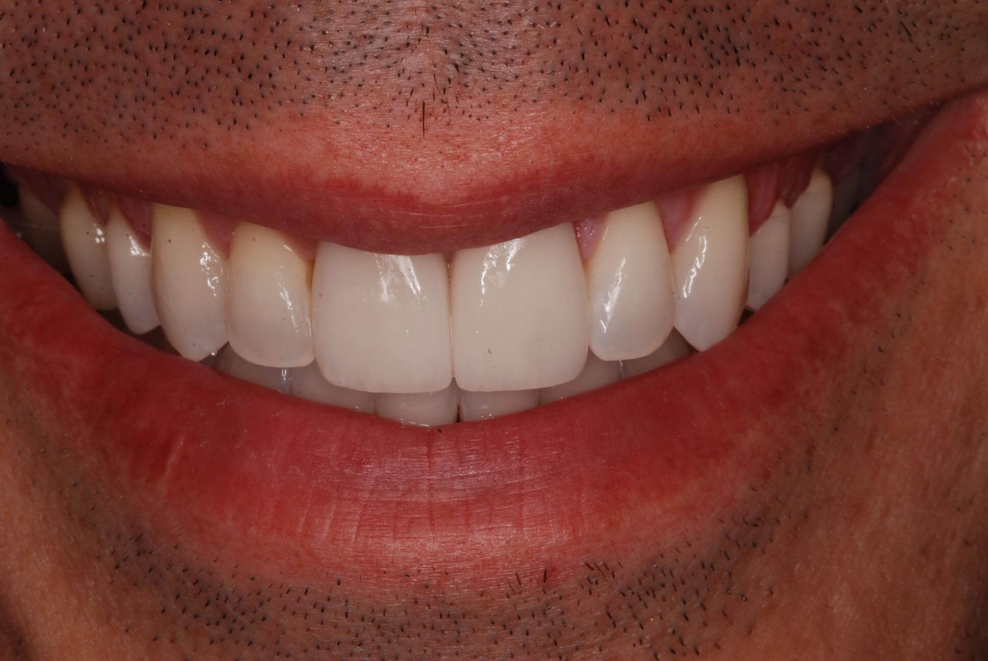 After Image