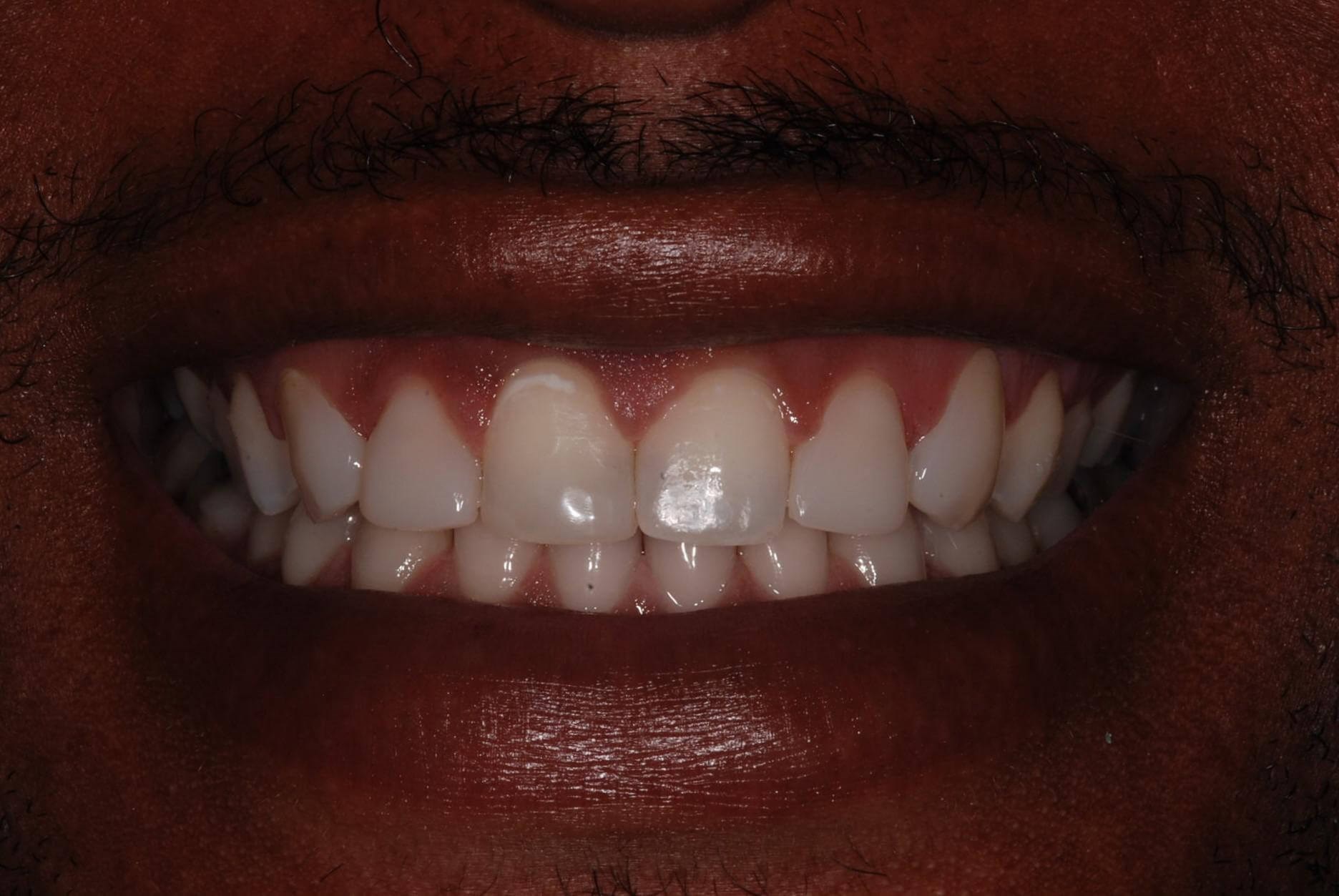 After Image