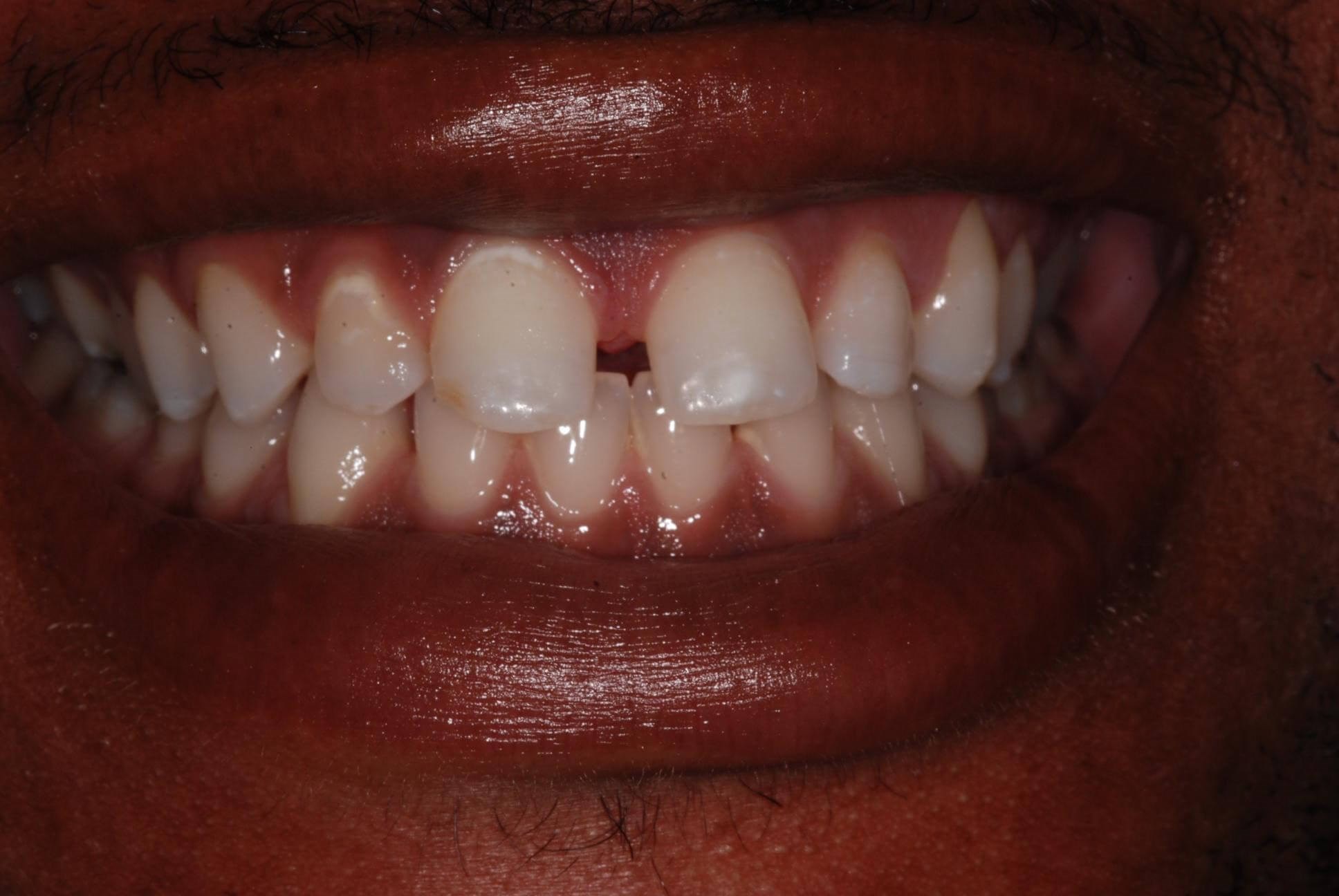Before Image