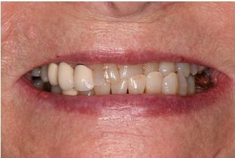 Before Image