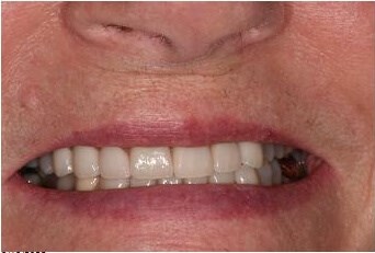 After Image