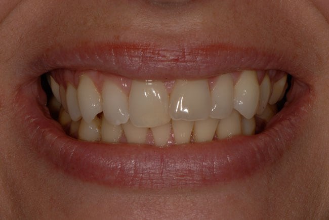 Before Image