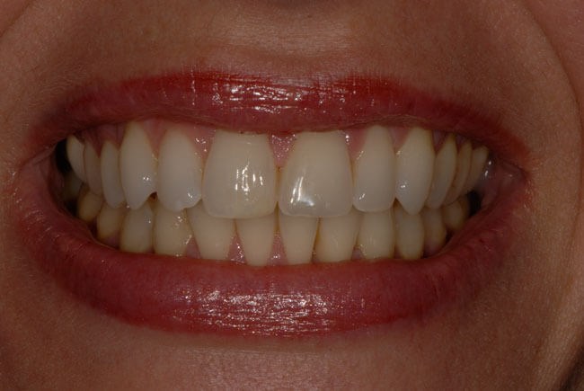 After Image