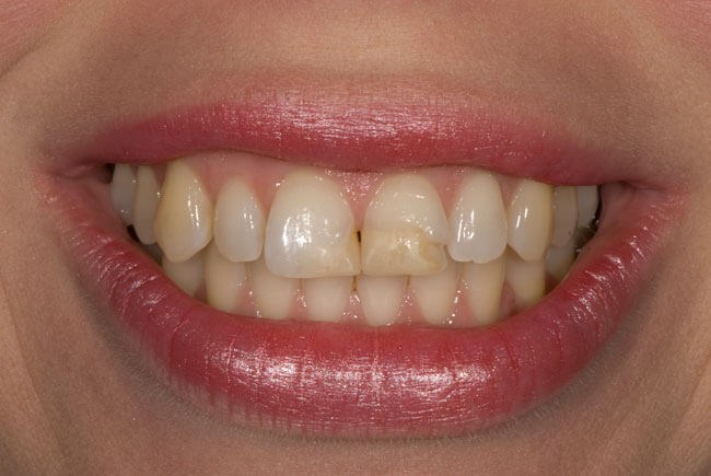 Before Image