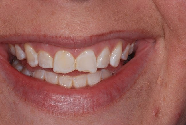 Before Image