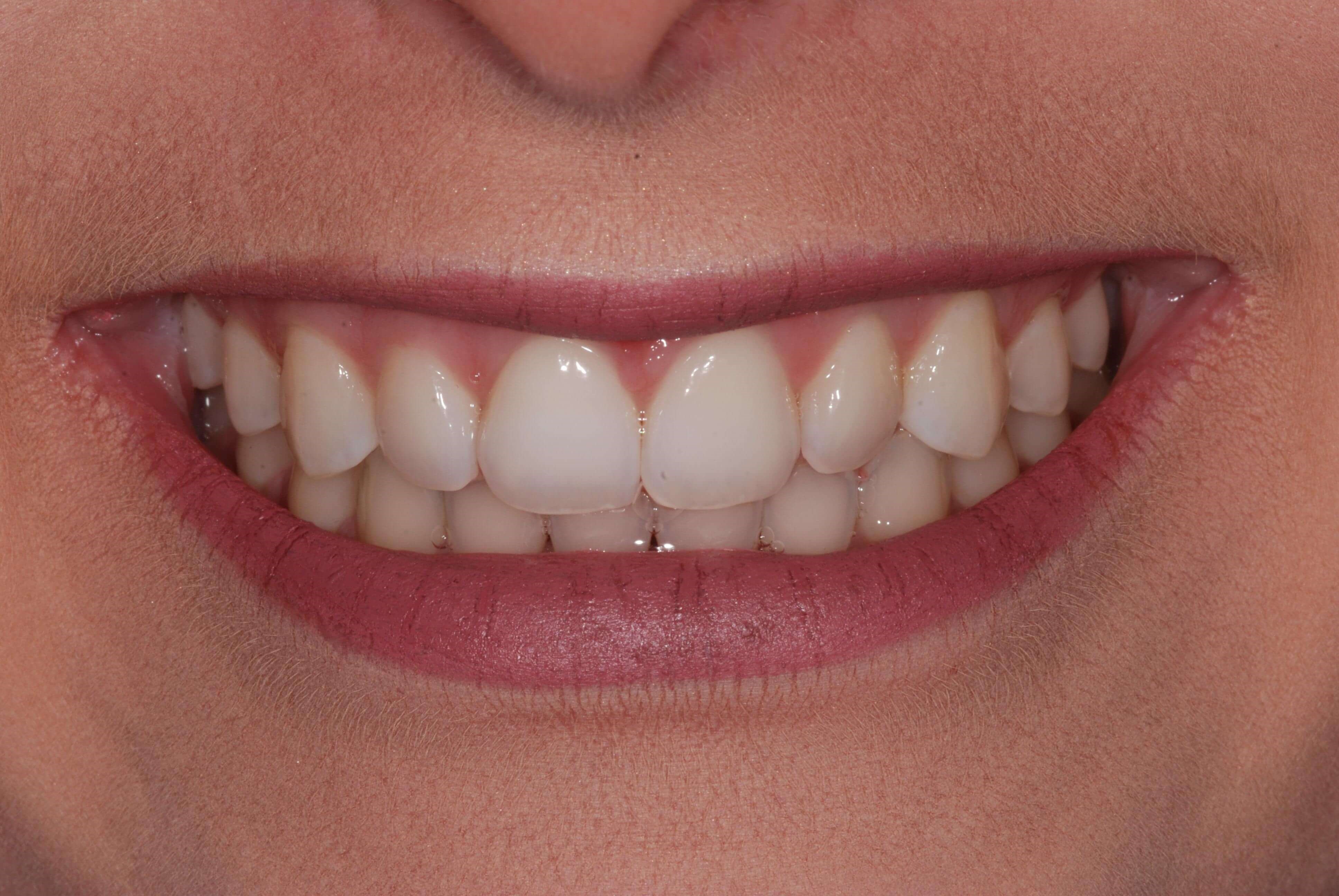 Before Image