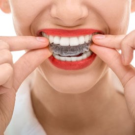 Retainers